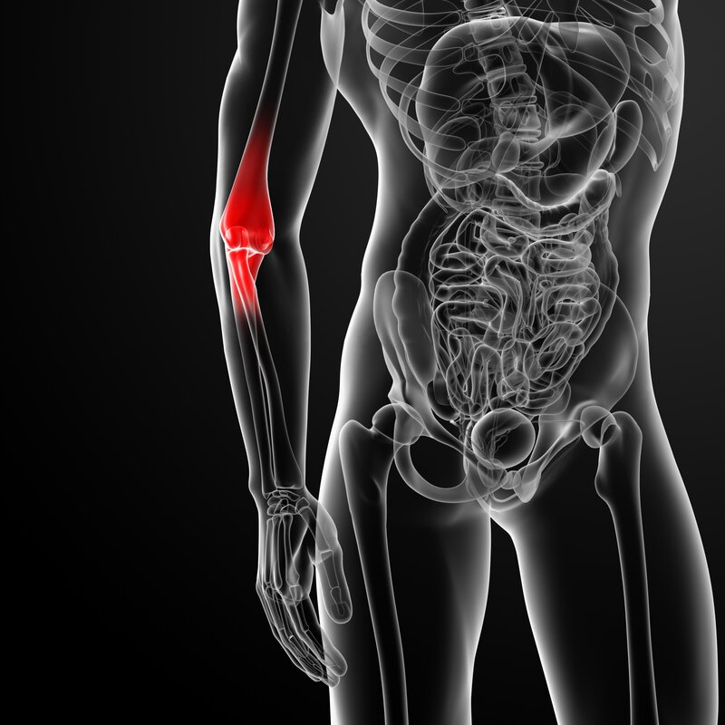 7 Tennis Elbow Home Remedies